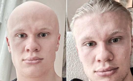 Σοκ με τον καραφλό Χάαλαντ