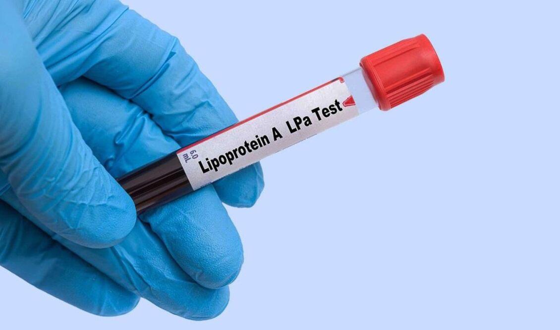 Η σιωπηλή απειλή: Όταν η λιποπρωτεΐνη α ενοχοποιείται για καρδιακές παθήσεις
