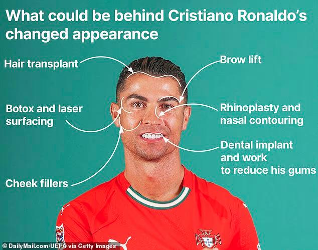 Κριστιάνο Ρονάλντο: Όλες οι επεμβάσεις που τον έκαναν αγνώριστο