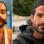 Άρης Μουγκοπέτρος: το νέο χειρουργείο και η αποκατάσταση