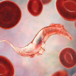 Η νόσος Chagas μεταναστεύει: Ραγδαία αύξηση των κρουσμάτων στην Ευρώπη  