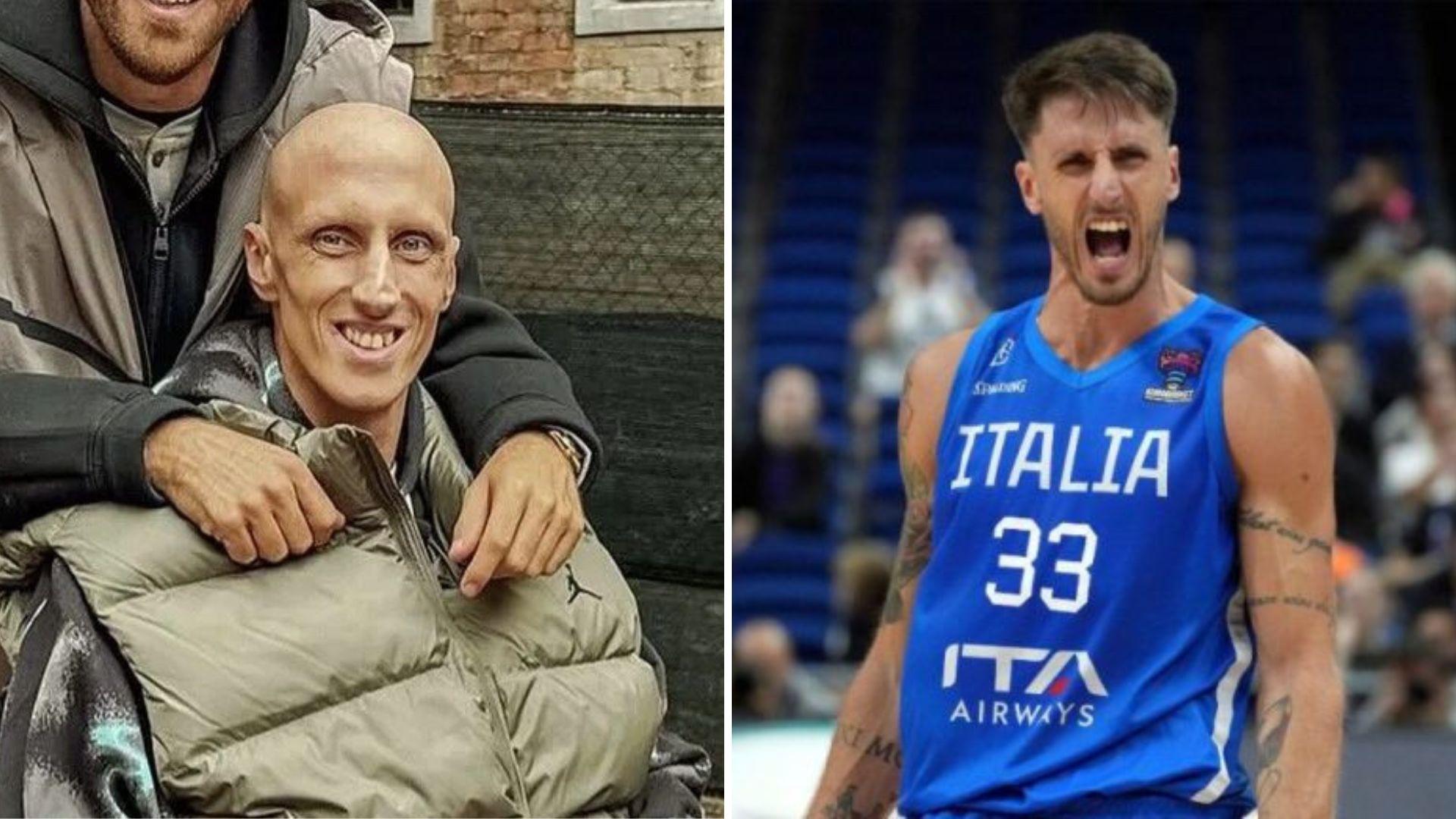 Ο Ακίλε Πολονάρα ξύπνησε από δεκαήμερο κώμα