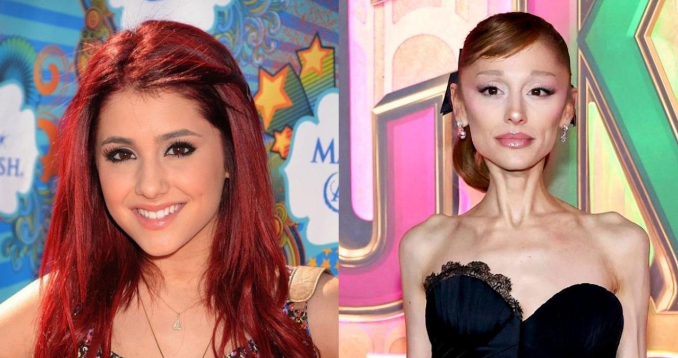 Αριάνα Γκράντε: Τι λέει για τη σοκαριστική εμφάνισή της