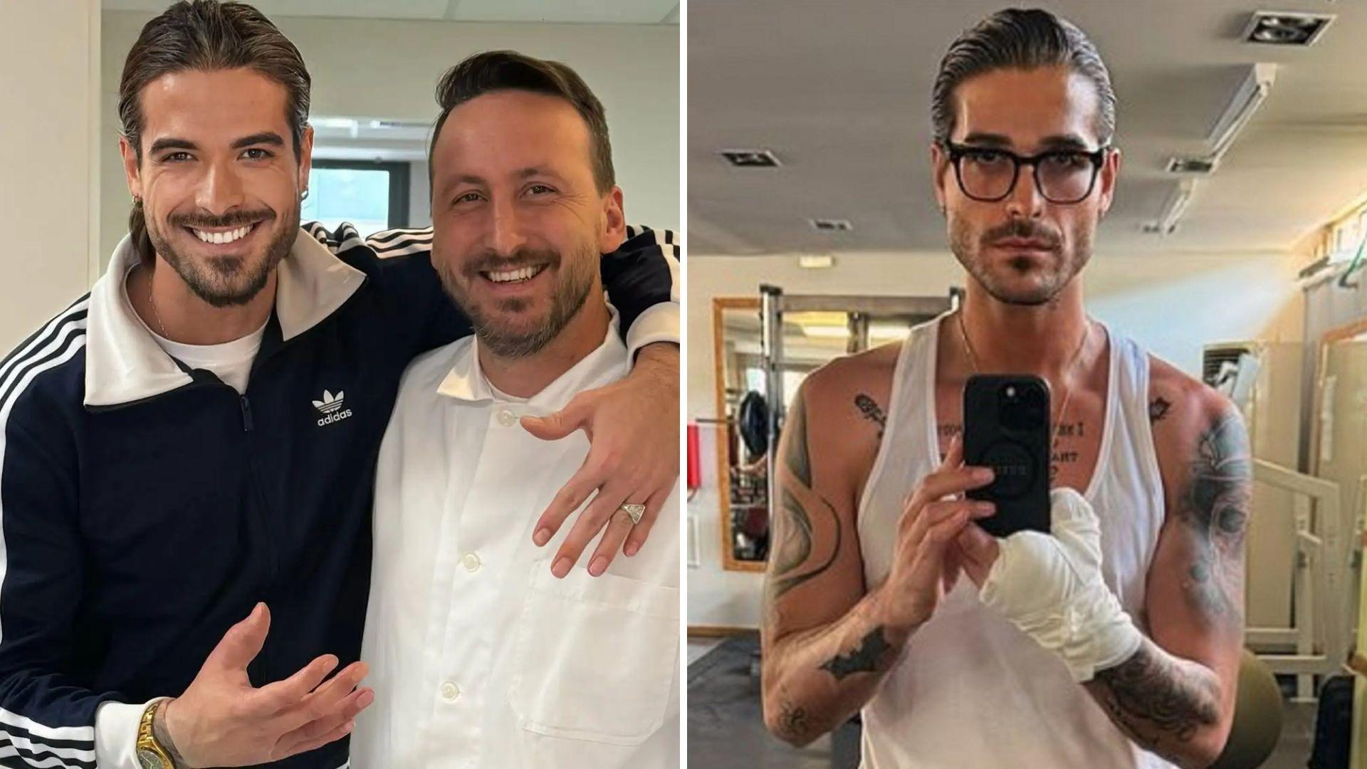 Ο Άρης Μουγκοπέτρος μας έδειξε τα δύο πρόσθετα δάχτυλα!