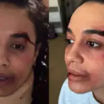 Πηνελόπη Πλάκα με μώλωπες και αίματα : «Πήρα τη μαμά μου…»